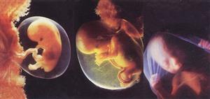 胚胎的发育