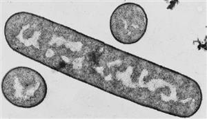 大肠杆菌电镜照片